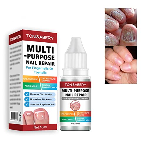 Fungal Nail Treatment,Nail Fungus Treatment For Toenail,Toe Nail Fungal Treatment,Toenail Fungus Treatment,Fungal Nail Treatment For Toenails Extra Strong,Fingernail Toenail Care Nail Repair
