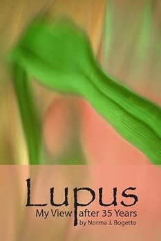 Paperback Lupus - My View After 35 Years Book