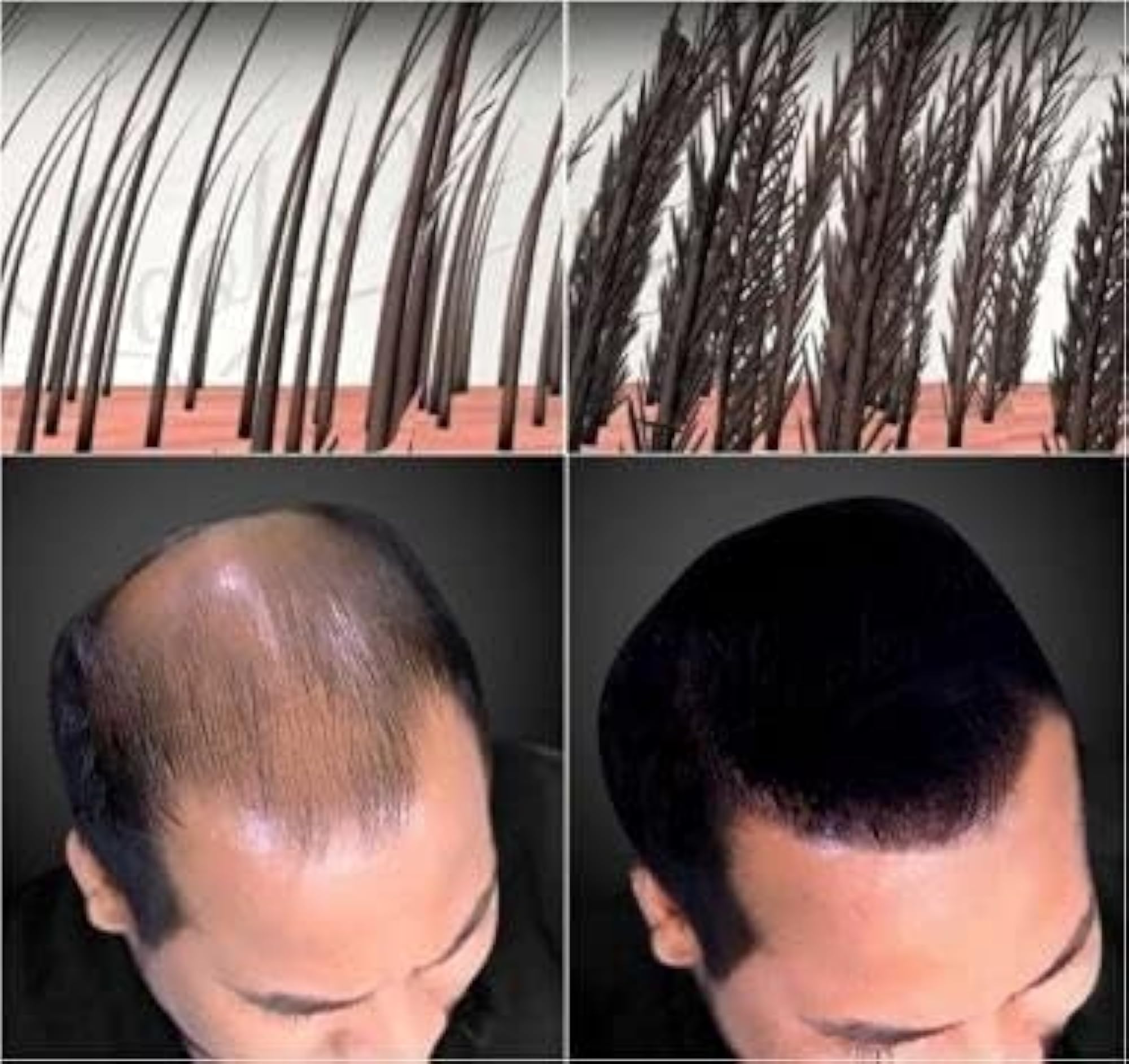 Toppi Premium Hair Building Fibers (Dark Brown)