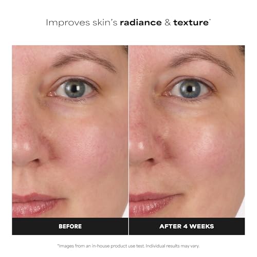 Paula's Choice SKIN BALANCING Pore-Reducing Face Toner with Niacinamide, for Oily Skin & Combination, Minimizes Large Pores, Controls Oil & Shine, Hydrates & Replenishes, Fragrance-Free - Image 5