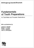Amazon.com: Fundamentals of Tooth Preparations: For Cast