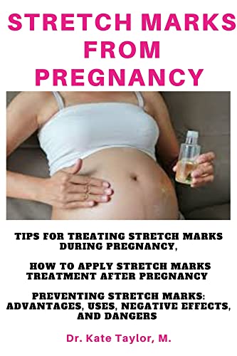 Stretch Marks From Pregnancy : Tips for Treating Stretch Marks during pregnancy, how to apply stretch marks treatment after Pregnancy (English Edition)