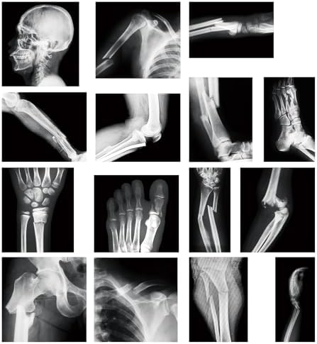 Sayglossy 15 Pcs Human X-Rays Black and White Skeleton Anatomy Set