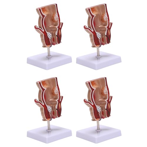 OSJYEGW 4X ��U�w���f�� �q�g�������j�a�σ��f�� ���ᑗ􏝕a���w���烂�f��