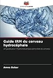  Guide IRM du cerveau hydrocéphale: Un guide pour l\'hydromécanique perturbée du cerveau