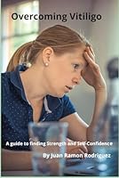 Overcoming Vitiligo: A Guide to Treating Your Skin and Strengthening Your Confidence B0F5NW9T6Y Book Cover