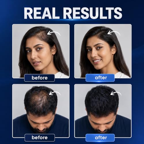 Image of Capilus Hair Building Fiber for Men & Women, Instant Hair Thickening Fibres for Thinning & Bald Spots, Natural-Looking, Concealer Powder for Fuller Look in 30 Seconds, 28g (Black, 28g)