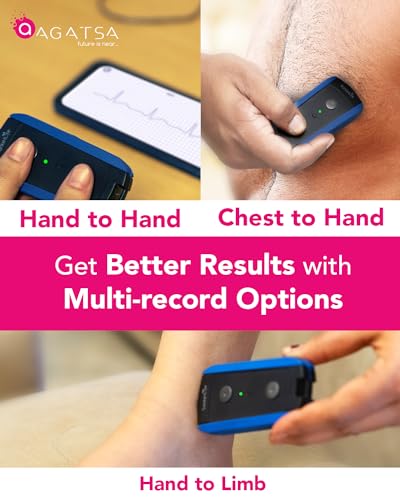 Image of SanketLife Pro+ Pocket ECG Machine | 12 Lead ECG by Touch & Leads | Convertible ECG Monitor for Home, Clinic | Unlimited Free 12 Lead ECG, HRV Monitoring | Keychain-Size ECG Device | Free Demo