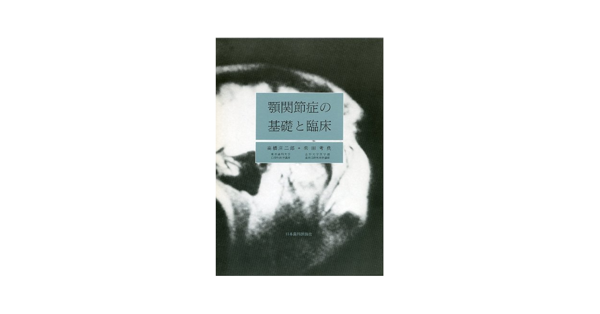 顎関節症の基礎と臨床 [単行本] 高橋 庄二郎; 柴田 考典 Amazon.co.jp: 顎関節症の基礎と臨床 : 高橋 庄二郎, 柴田 考典: 本