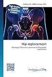  Hip replacement