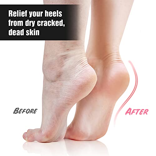 Codream Moisturizing Heel Gel Socks: Heal Dry Cracked Heel Treatment Overnight Pedicure Foot Spa Sock | 2 Pairs Soft Silicone Moisturizer Sleeve To Repair Callus Rough Heel #TOP2