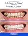 Supersmile Professional Teeth Whitening System – Toothpaste & Accelerator – Clinically Proven Formula for Visibly Whiter Teeth