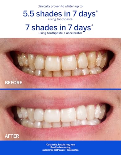 supersmile professional whitening accelerator - powerful whitening without sensitivity - safe and effective on dental restorations 36 oz