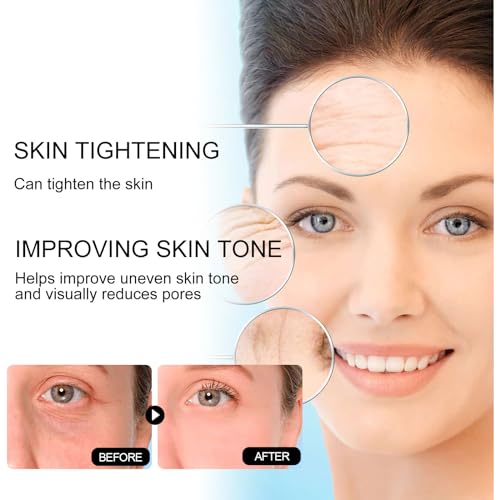 Generic Aobenz Spot Remover Serum For Face, Aobenz Remover Freckle Essence, Melasma Freckle, Sun Spot, Age Spot, Brown Spot, Spot Corrector Facial Serum For All Skin Types Spot For Men And Women thumb #3