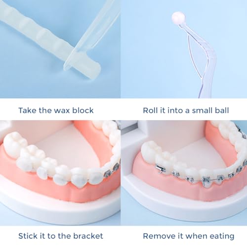 Opiniones y reviews de Cera para brackets precio , tabla con los diez mejores. 8