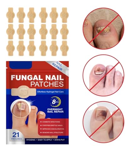 Image of Advanced Fungal Nail Patch Treatment (20 PATCH) Powerful Antifungal Solution | Targets Nail Fungus at the Root | Easy-to-Use Patch for Toenail & Fingernail