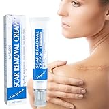 Narbensalbe,Scar Cream, Narben Entfernung Creme, Glatte Haut, Gesichts Haut Reparatur Creme, Verwendet für Narben Hyperplasie und Glätten (1 Stück)