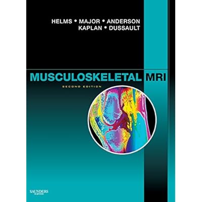 Musculoskeletal MRI