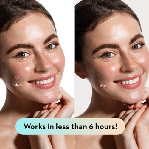 image for LE GUSHE Korean Pimple Patches for Face (132 Dots) - Hydrocolloid Acne