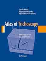 カラーアトラスdermoscopy Amazon | Color Atlas of Dermatoscopy | Stolz, Wilhelm, Braun