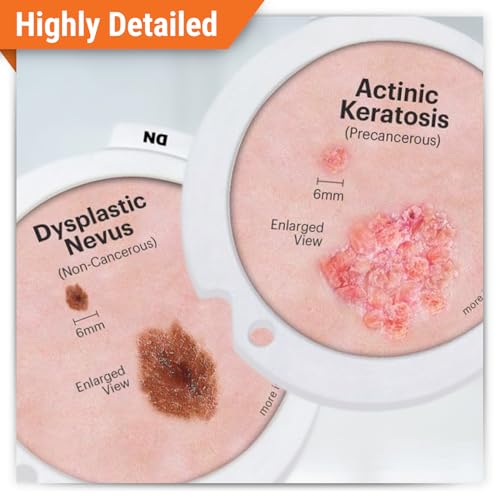Image of GPI Anatomicals Skin Cancer Model with Precancerous & Cancerous Skin Lesion