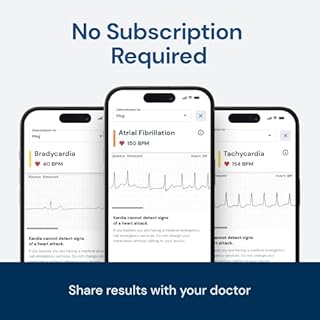 KardiaMobile 1-Lead EKG Monitor, Medical-Grade FDA-Cleared Personal Heart Monitor, Detects Normal, AFib & Arrhythmias, 30 Second Results, Works with Most Smartphones, HSA&FSA Eligible