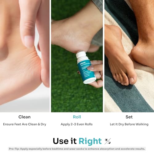 Image of Kitcoz Foot Cream Roll On with 20% Urea, 2% Lactic Acid, Glycerine & Olive Oil for Dry Feet, Cracked Heels & Diabetic Foot | Non Sticky Formulation - 50ml