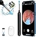 Price comparison product image Oxbird Ear Wax Removal Kit Tool with Camera, 1080P Wireless Earwax Camera Ear Camera Otoscope Cleaner Smart Ear Cleaner with Camera and Light for iPhone, Ipad & Android Smart Phones (Black)