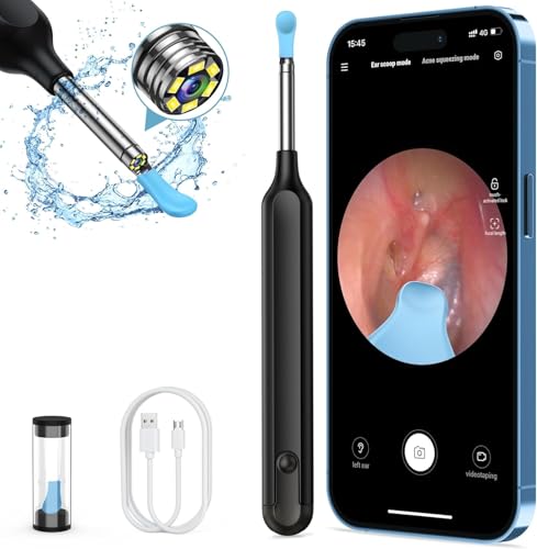 Image of Oxbird(200-300W-PX) HD Wireless Otoscope with Light Ear Wax Camera, Ear Wax Remover Removal Cleaner Cleaning Kit, Suitable for Apple /Android, Dad and Madam Artifact,Perpetual Commitment