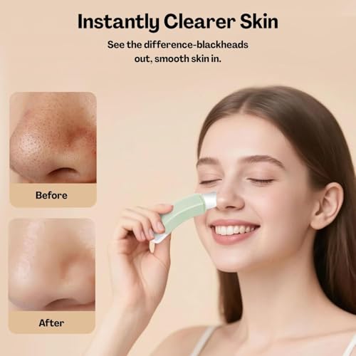 Image of Black Head Remover Tool, Deep-Cleansing Pore Scrubber with Easy-Grip Handle | Dual-Head Design | Stainless Steel | Gentle on Skin | Portable | For Men & Women