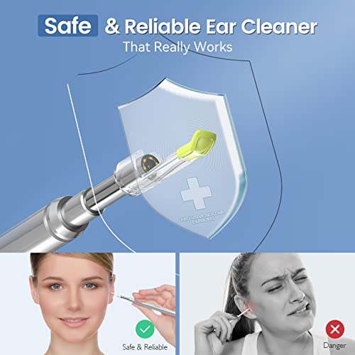 Anykit Digital Otoscope With 5" Ips Screen, 3.9Mm Ear Camera With 6 Lights, 720Phd Ear Scope With Rechargeable Battery, Storage Case, 32Gb Card, Supports Photo Snap And Video Recording #TOP2