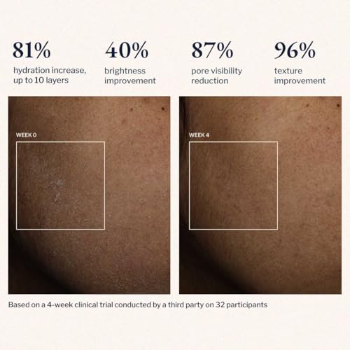 Image of FLOUT Boundless Face Moisturiser for Oily, Dry & Combination Skin | Niacinamide + Ceramides + Peptides Gel Cream | Oil-Free, Non-Greasy Barrier Repair Day & Night Cream | Women & Men