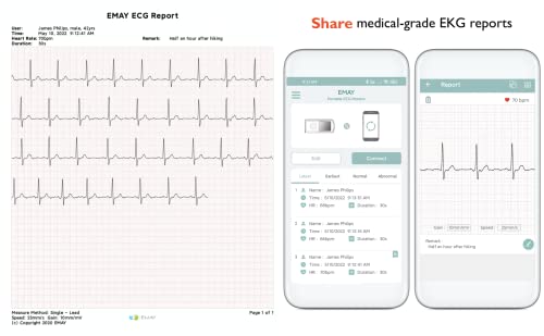 Emay Portable Ecg Monitor (For Iphone & Android, Mac & Windows) | Wireless Ekg Monitoring Devices With Heart Rate & Rhythm Tracking #TOP3