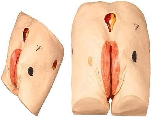 Teaching Model Tools,Adult Senior Pressure Ulcers Nursing Model 4 Stages of Bedsore Caused by Pressure Ulcer Manikin Teaching Human Simulator for Science Classroom Study Display Te