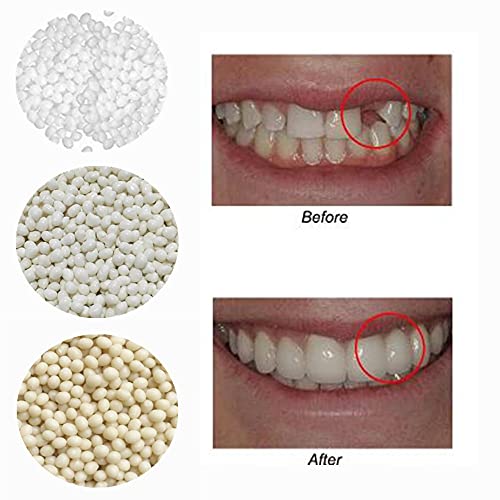 10Pcs Dental Oral Fake Teeth Tooth Covers Molds With 3Colors Repair Snap On Smile Veneers Dentures Adhesive Beads Cosmetic Kits #TOP4