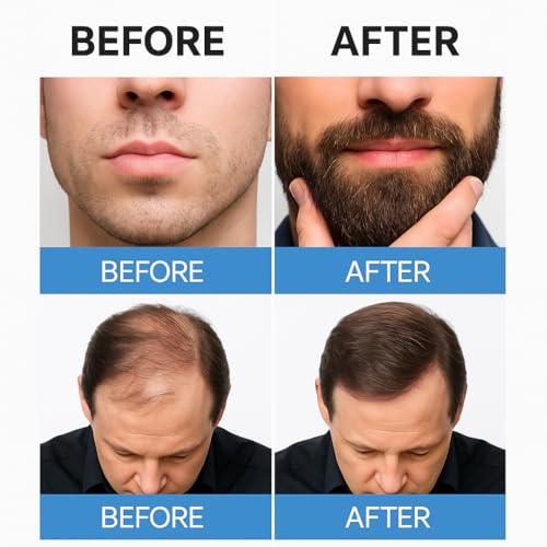 Minoxidil Liquid Extra Strength Hair Regrowth Treatment for Men, 5% Topical Solution, 6 Months Supply - Dropper Applicator and Bonus Free Instructional Guide Included