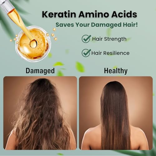 Moist Diane Anti Dandruff Shampoo for Women, Dry Itchy Scalp Shampoo for Men with Keratin, Mint, Rosemary, Collagen & Vitamin E, Paraben Free Tea Tree SHAMPOO from Japan 15.2 Fl Oz FRESH& HYDRATE