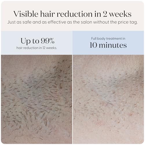 smoothskin pure fit ipl hair removal device  at-home laser hair removal for women amp men visible results in 2 weeks includes precision head safe for face amp body long-lasting hair reduction