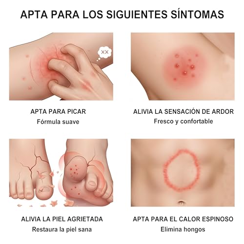 Miniatura 3 de Crema Antimicótica Para La Piel - Crema Antimicótica Para El Pie De Atleta, La Tiña Inguinal Y La Tiña - Fórmula Suave - Apta Para Pies Y Cuerpo 18g 1-Pack
