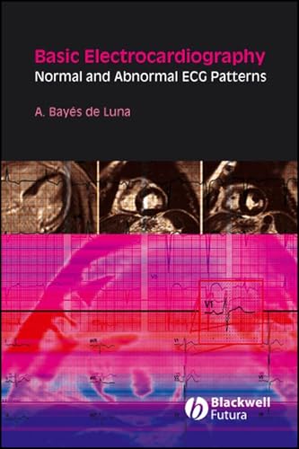 Basic Electrocardiography: Normal and Abnormal ECG Patterns view 2