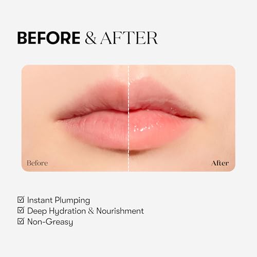 VTCOSMETICS Reedle Shot Lip Plumper, 0.15 oz (4.3 g), Moisturizing, Transparent, Lip Gloss, Fragrance-free, Korean Cosmetics (Beginner)