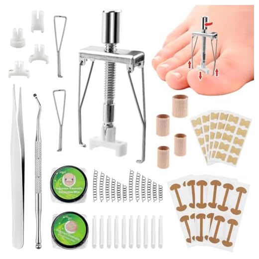 Juego de Uñas Encarnadas, Corrección de Uñas de los Pies, Soporte Curvo para Uñas de los Pies, Juego de Cuidado de los Pies para Uñas Encarnadas, Juego de Cortauñas Profesionales para Uñas Encarnadas