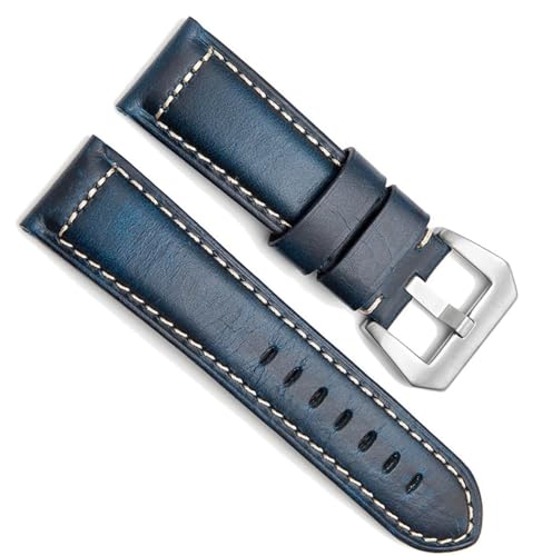 ���U�[�E�H�b�`�o���h �I�C�����b�N�X�E�H�b�`�X�g���b�v �E�H�b�`�x���g �o�b�N�� �����p�A�N�Z�T���[