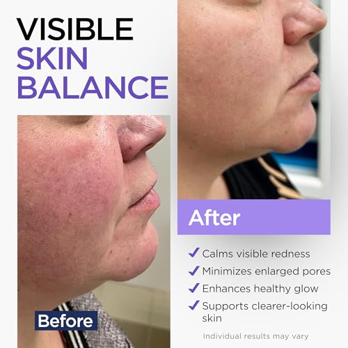 Image of Niacinamide Serum for Face 10% with Zinc 1% Vitamin B3 2 Oz
