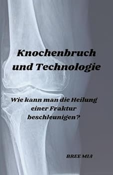 Knochenbruch und Technologie: Wie kann man die Heilung einer Fraktur beschleunigen? (German Edition)