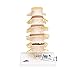 3B Scientific A795 Stages of Disc Prolapse and Vertebral Degeneration Model, 8.7" Height