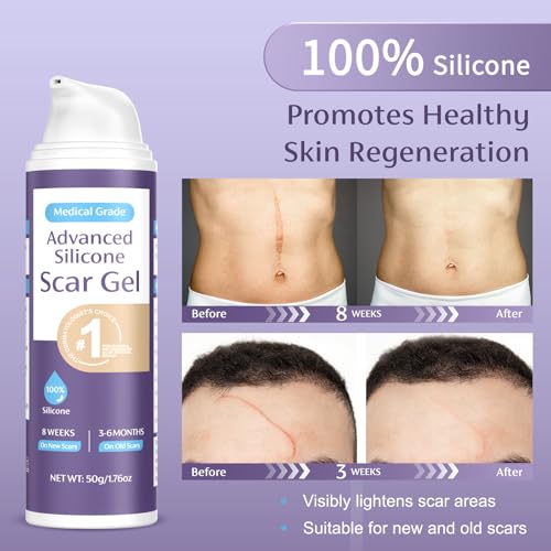 Skiennix T01 Advanced Scar Gel 1.76Oz thumb #3