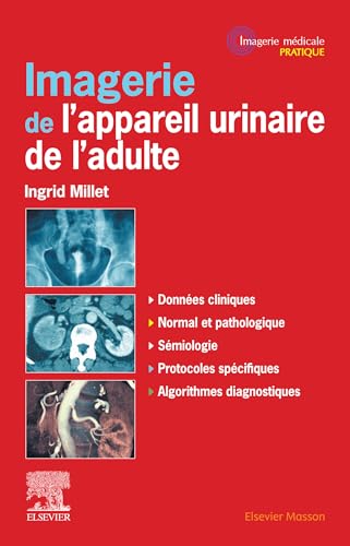 Imagerie de l'appareil urinaire de l'adulte (English Edition)