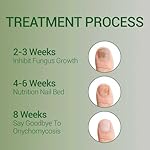 Nail Fungus Treatment Gel - Nail Growth Serum for Repair, Natural Best Repair Solution for Fingernails and Toenails, Multi-Purpose Nail Repair Oil Serum - 2 pcs - Image 4