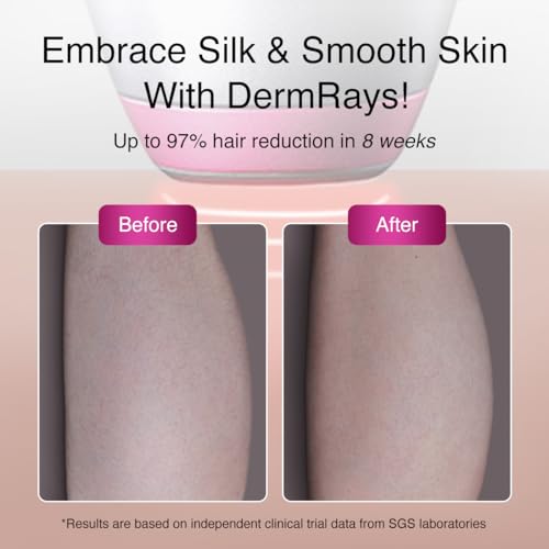DermRays Upgrated Diode Laser Hair Removal for Dark Skin Tones, DermRays 1064nm Laser Hair Removal, Permanent Reduction in Hair Regrowth for Women and Men, V6S Suitable for Deep Skin Tone & Melanated Skin Tone